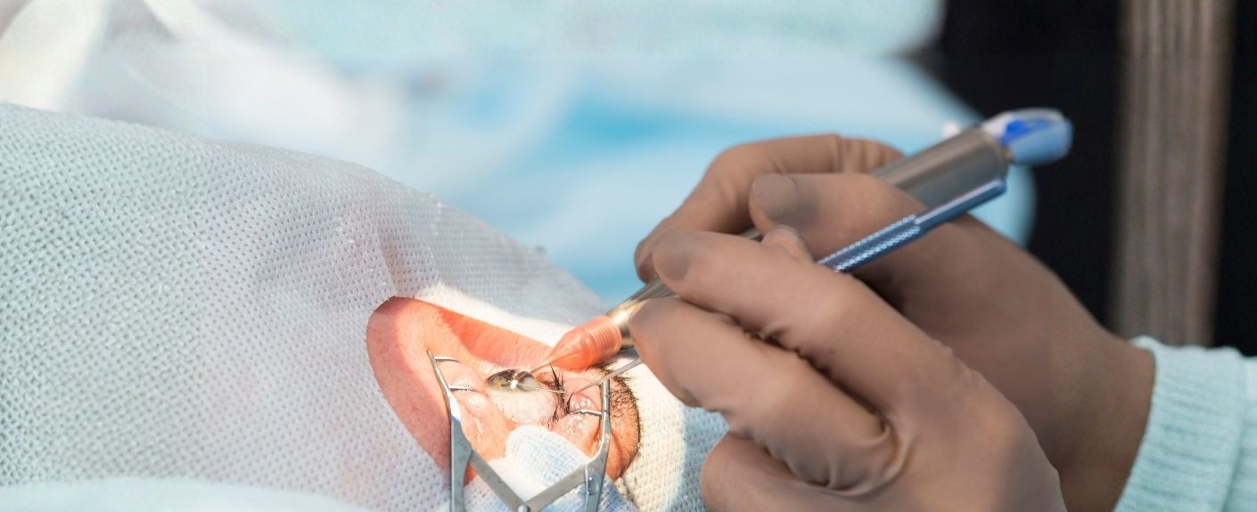 Phacoemulsification Complications: Risks and Management