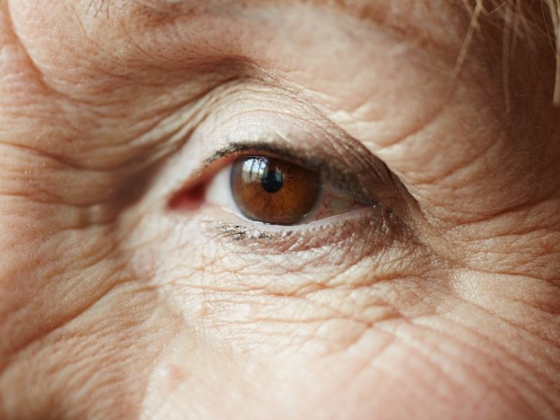 Ageing — temporary reference