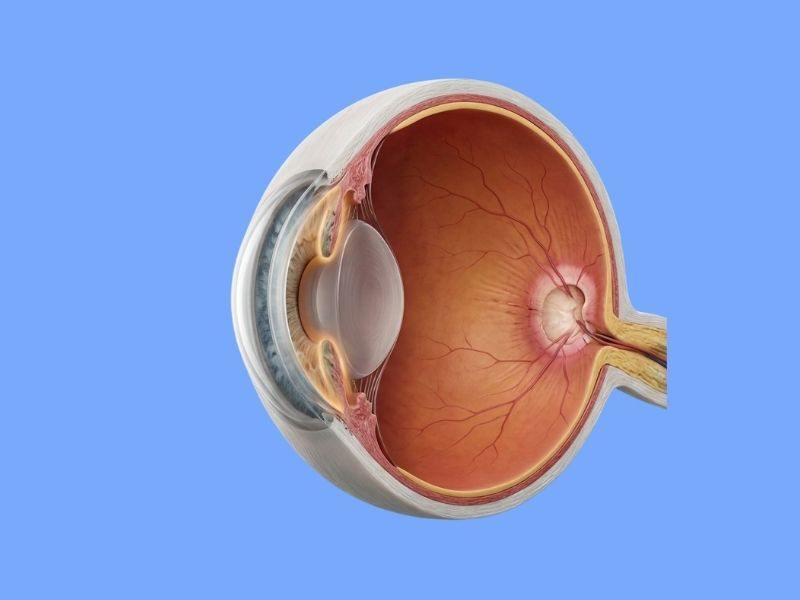 Angle-Closure Glaucoma — temporary reference