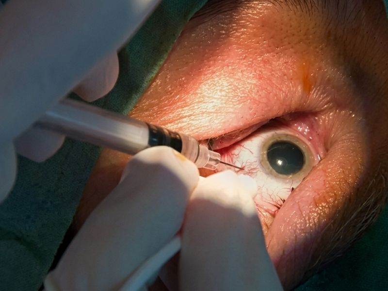 Anti-VEGF Injections