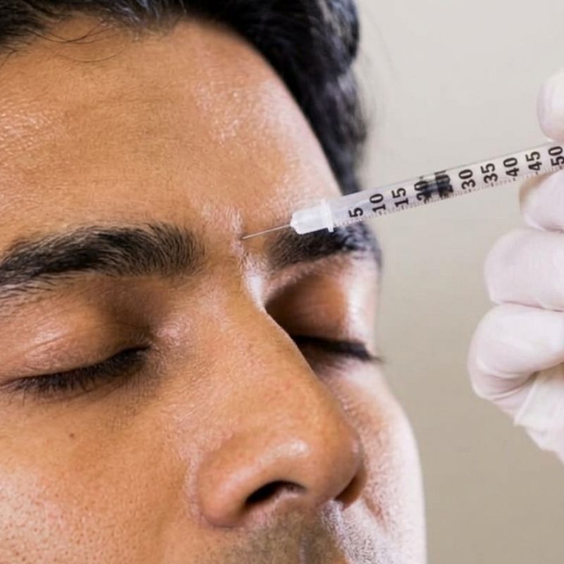 Botulinum Toxin Injections