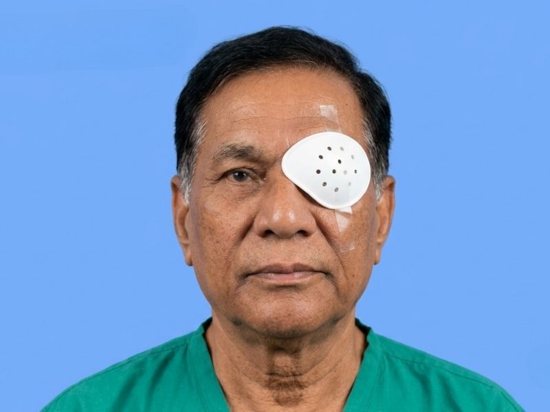 Cataract Surgery