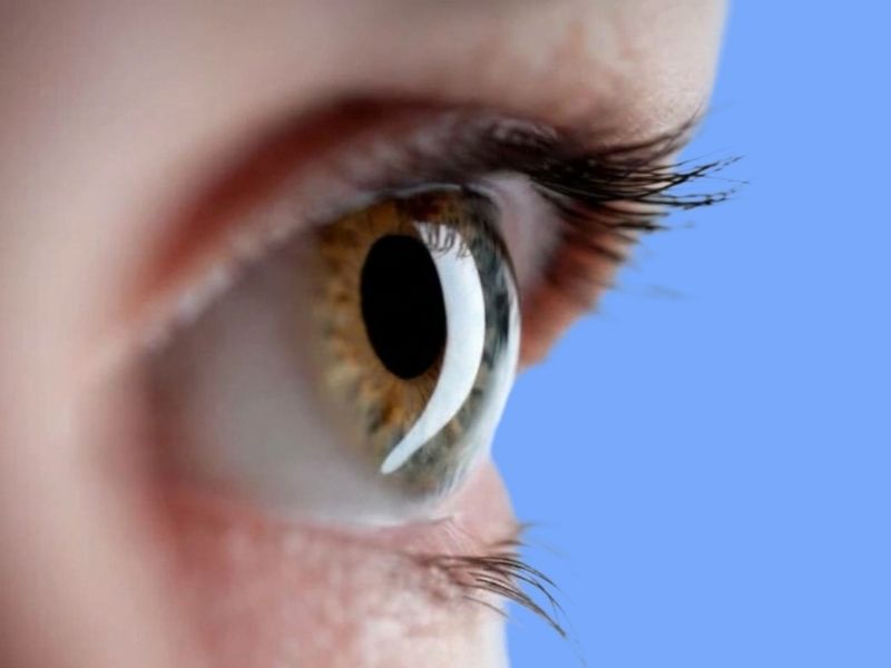 Corneal Dystrophies — temporary reference