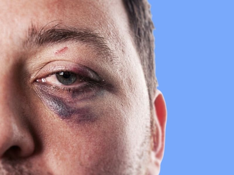 Corneal Injuries — temporary reference