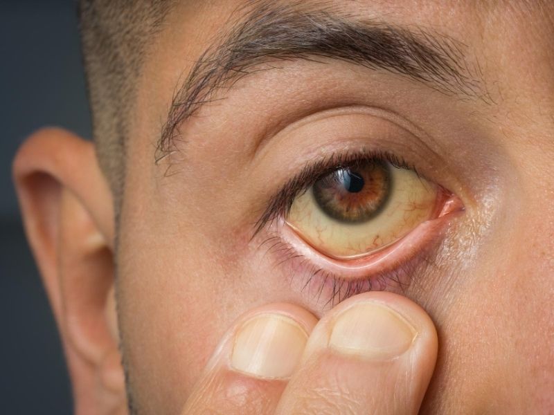 Eye Injuries & Inflammation — temporary reference