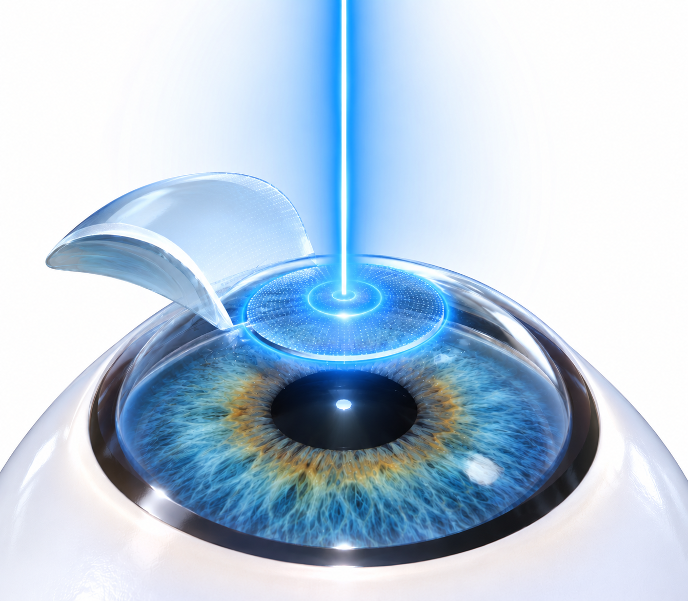 Surya Eye LASIK diagnostic equipment