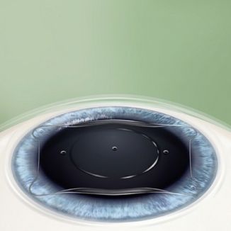 Temporary Retina reference image 5 — replace with clinic-specific image