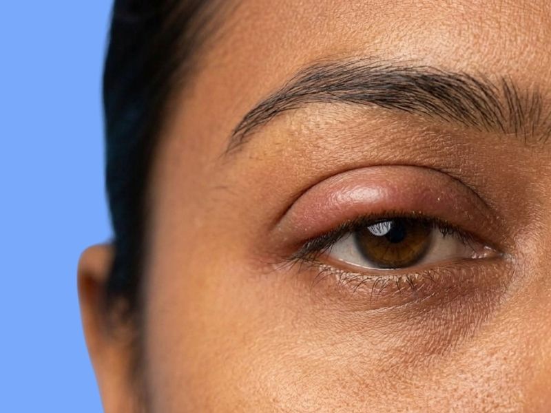 Temporary Retina reference image 2 — replace with risk factor image