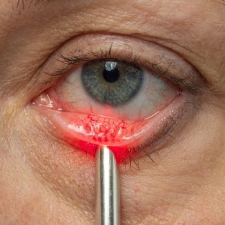 Temporary Retina reference image 4 — replace with clinic-specific image