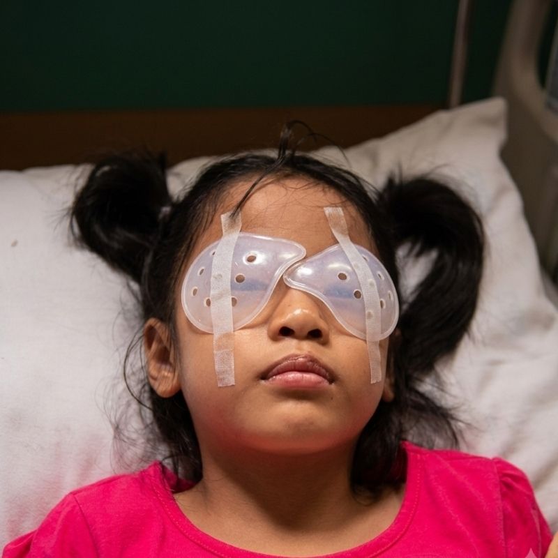 Pediatric Cataract Surgery — temporary reference image