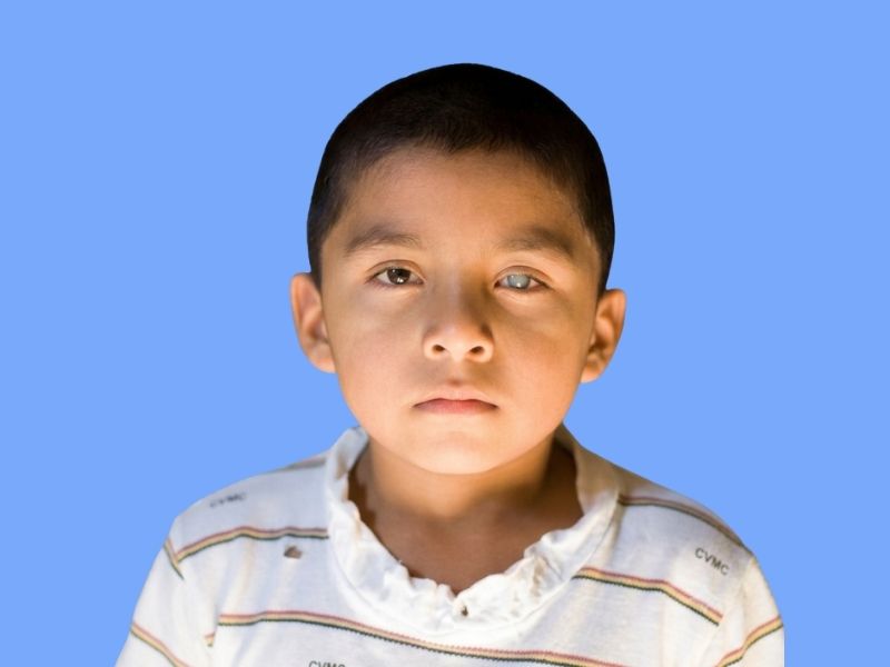 Pediatric Cataracts — temporary reference image