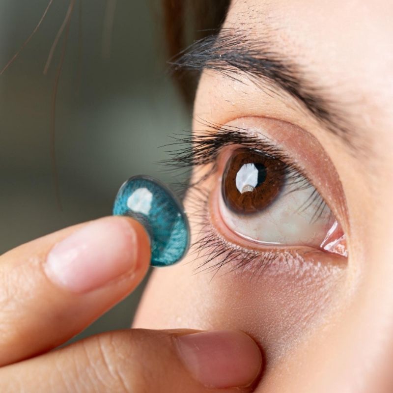 Contact lens placement for vision correction
