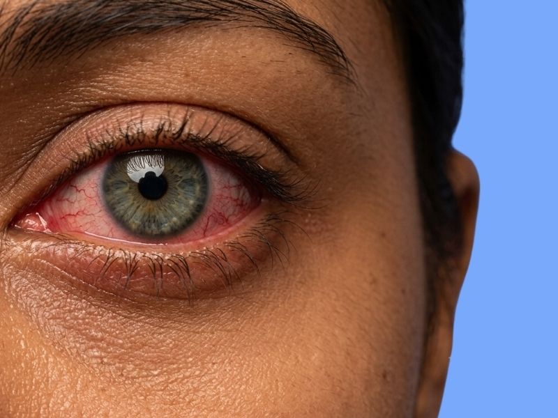 Temporary Retina reference image 1 — replace with risk factor image