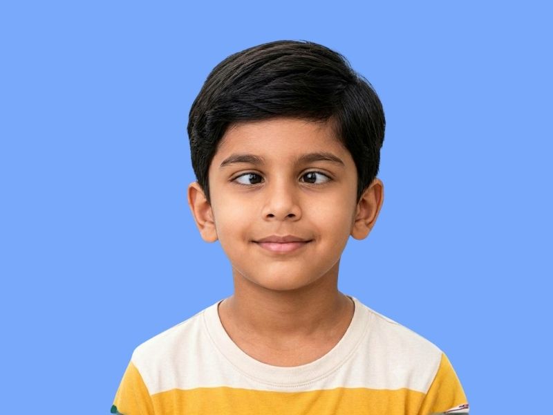 Squint (Strabismus) — temporary reference image