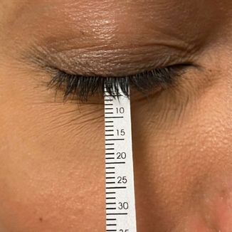 Tear Film Evaluation
