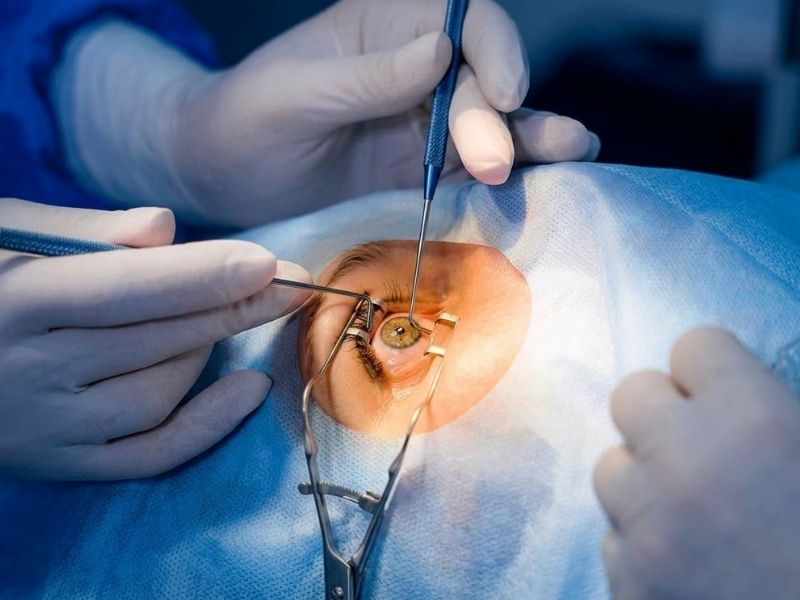 Vitrectomy Surgery